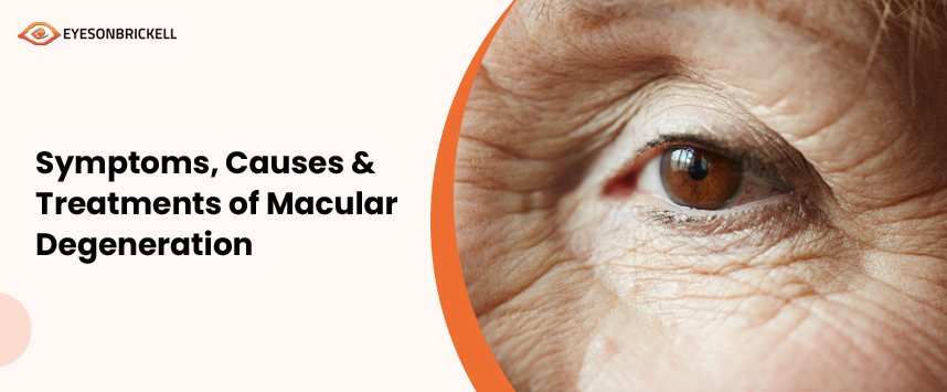 Eyes on Brickell: Macular Degeneration Service