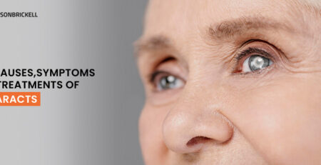 Eyes on Brickell: Cataracts: Causes, Symptoms, and Treatments