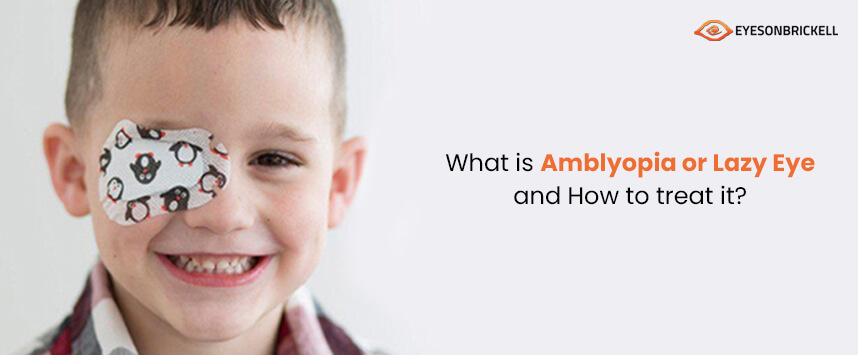 Eyes on Brickell: Amblyopia (Lazy Eye): Causes and Treatments