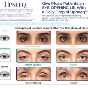 Eyes on Brickell: Upneeq Give Ptosis Patients an Eye-Opening Lift with a Daily Drop of Upneeq