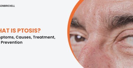 Eyes on Brickell: Ptosis Treatment Miami