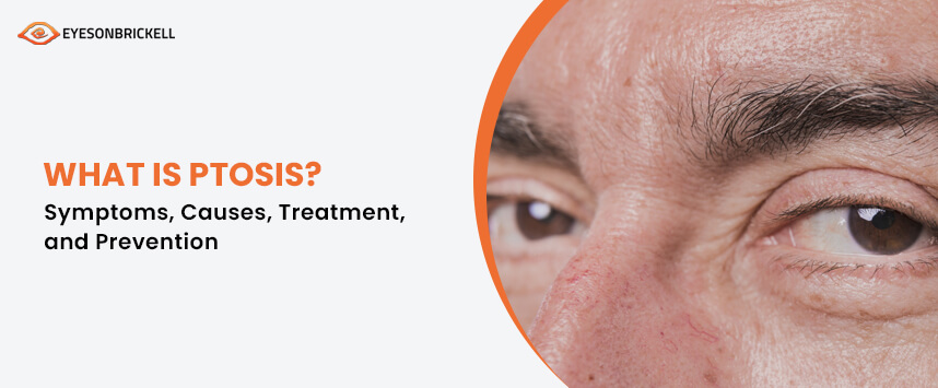 Eyes on Brickell: Ptosis Treatment Miami