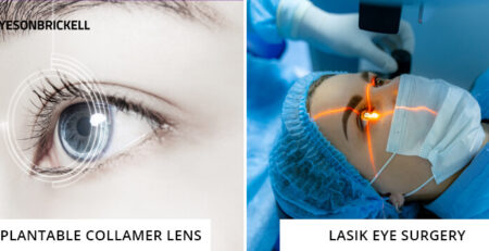 ICL vs LASIK