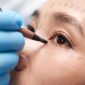 Ptosis Treatments