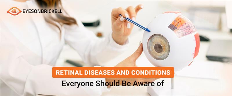 Retinal Diseases
